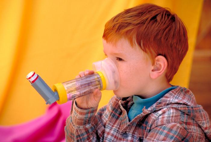 Early-life asthma may contribute to childhood obesity