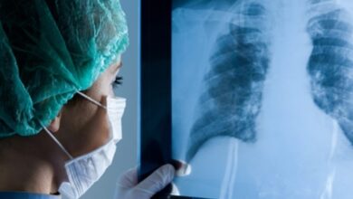 Pacientes latinoamericanos con hipertensión pulmonar desafían las expectativas mundiales