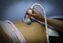 Proyecto de ley sobre aborto en Chile pone la decisión de las mujeres bajo un estetoscopio político