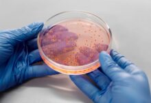 How a Contaminated Medical Scope Can Spread Deadly Infections