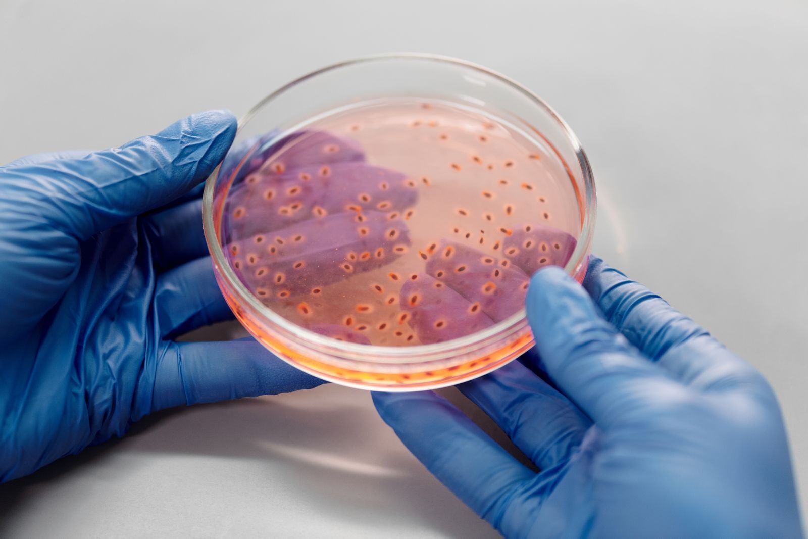 How a Contaminated Medical Scope Can Spread Deadly Infections